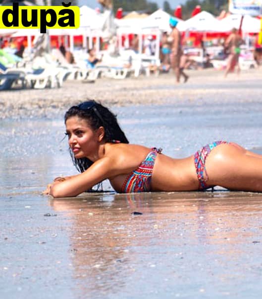 Cum arată Andreea Mantea după ce şi-a făcut lipoaspiraţie în zona intimă! A apărut la plajă, într-o pereche de bikini minusculi, şi toată lumea a sesizat diferenţa