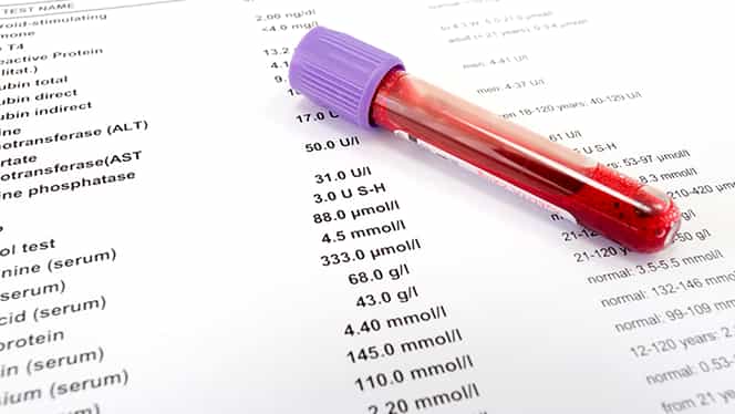 Specialiștii în medicină, descoperire de ultimă oră: ”Cu testul de sânge se pot verifica peste 50 de tipuri de cancer”