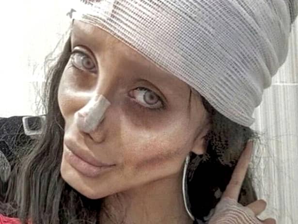 Femeia care și-a făcut nenumărate operații estetice ca să arate ca Angelina Jolie a fost arestată. Sahar Tabar