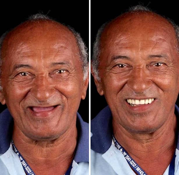 Un stomatolog brazilian îi ajută pe cei sărmani să își facă dinții. Galerie foto cu oamenii cărora le-a schimbat aspectul fizic
