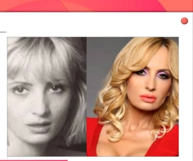 Bianca Drăgușanu, total schimbată după operațiile estetice. A cheltuit zeci de mii de euro pe intervenții chururgicale