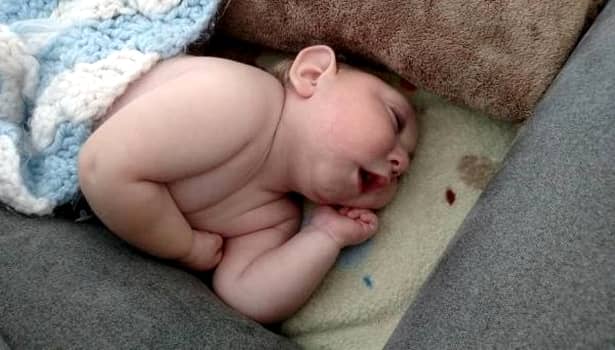 FOTO&VIDEO. Bebeluşul născut cu jumatate de craniu continuă să uimească lumea medicală