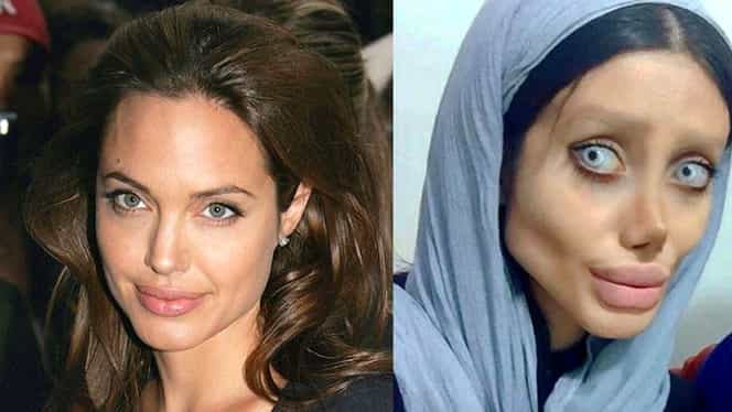 Și-a făcut 50 de operații pentru a semăna cu Angelina Jolie