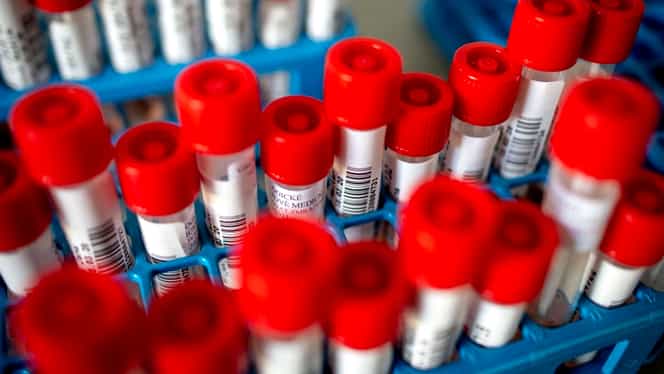 Adolescentă de 12 ani, ultima victimă a coronavirusului în Belgia! Numărul persoanelor testate pozitivi – 12.775
