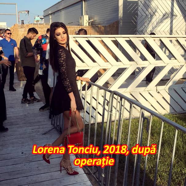 Așa arată Lorena Tonciu, în 2018! Sora Andreei este de nerecunoscut după ce s-a operat