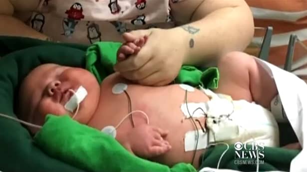 Ali James Medlock, bebeluşul care s-a născut cu o greutate de 7 kilograme