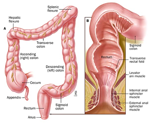 Ce este cancerul de colon? Cum poți depista tumorile, diagnostic și tratament