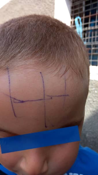 Caz şocant la o grădiniţă din Gorj! Un copil a fost scris cu pixul pe faţă de educatoare! Motivul este halucinant