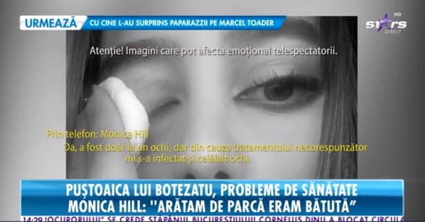 Monica Hill, iubita lui Cătălin Botezatu, suferă de o afecțiune gravă la ochi. În ce stadiu e acum
