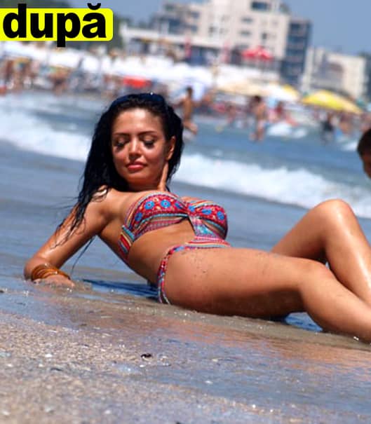 Cum arată Andreea Mantea după ce şi-a făcut lipoaspiraţie în zona intimă! A apărut la plajă, într-o pereche de bikini minusculi, şi toată lumea a sesizat diferenţa