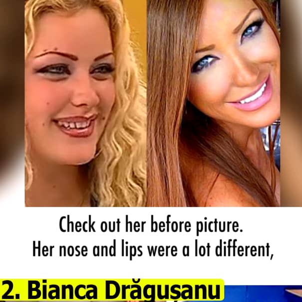 Americanii au inclus-o pe Bianca Drăguşanu în TOP 10 – Femei din plastic. „Uitaţi-vă cum arăta înainte!” Cu ce animal o compară!