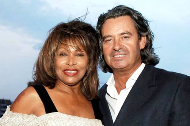 Tina Turner, transplant de rinichi! Soțul i-a salvat viața