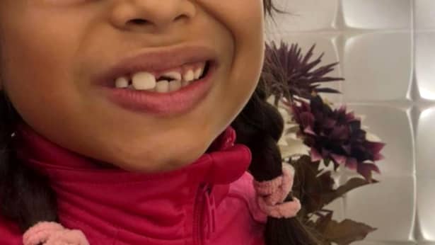 Fiica lui Laurette s-a ales cu dinții sparți la școală, după un atac rasial