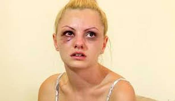 Alexandra Stan, din nou cu fața lovită! Ce a pățit artista!