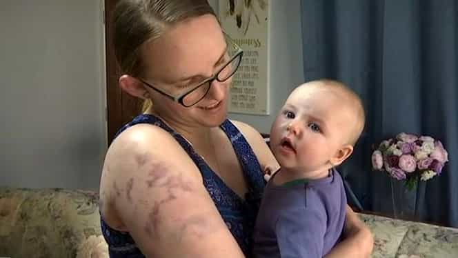 O mamă și-a folosit trupul ca scut pentru a-și proteja bebelușul de 4 luni