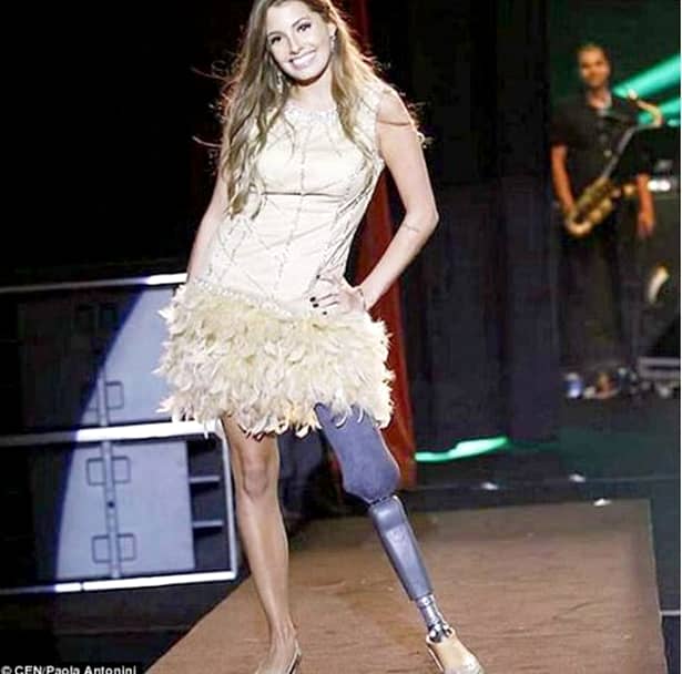 GALERIE FOTO. Test de curaj! Un model brazilian a rămas fără un picior după un accident teribil, dar nu a renunţat la VISUL său