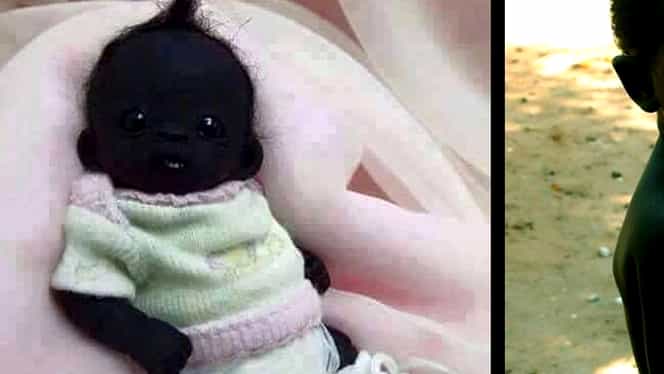 Cel mai negru copil din lume a crescut mare!  CE TRANSFORMARE! Cum arată acum