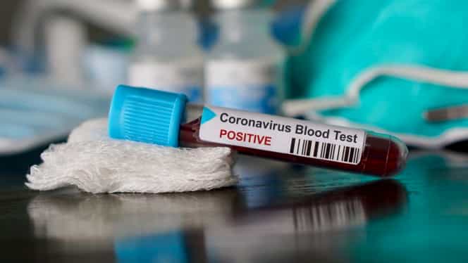 Microbiologii spanioli, avertisment în lupta împotriva coronavirusului: ”Testele rapide fabricate în China nu sunt sigure”
