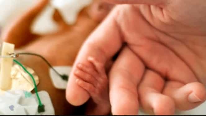 Un bebeluș din Portugalia s-a născut fără chip. Părinții dau vina pe un medic