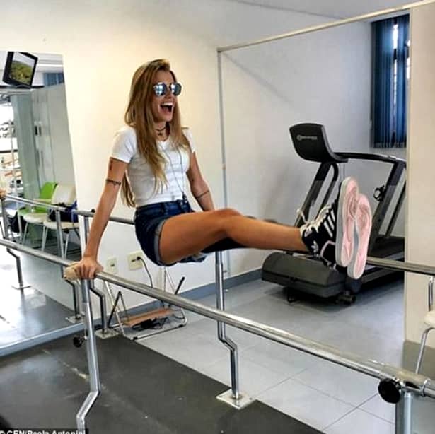 GALERIE FOTO. Test de curaj! Un model brazilian a rămas fără un picior după un accident teribil, dar nu a renunţat la VISUL său
