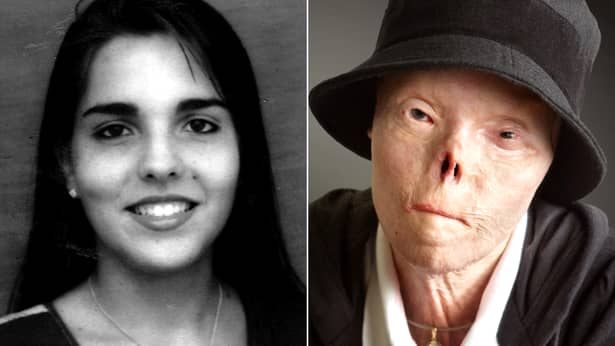 Jacqui Saburido, femeia desfigurată devenită simbol al luptei condusului sub influența alcoolului, a murit