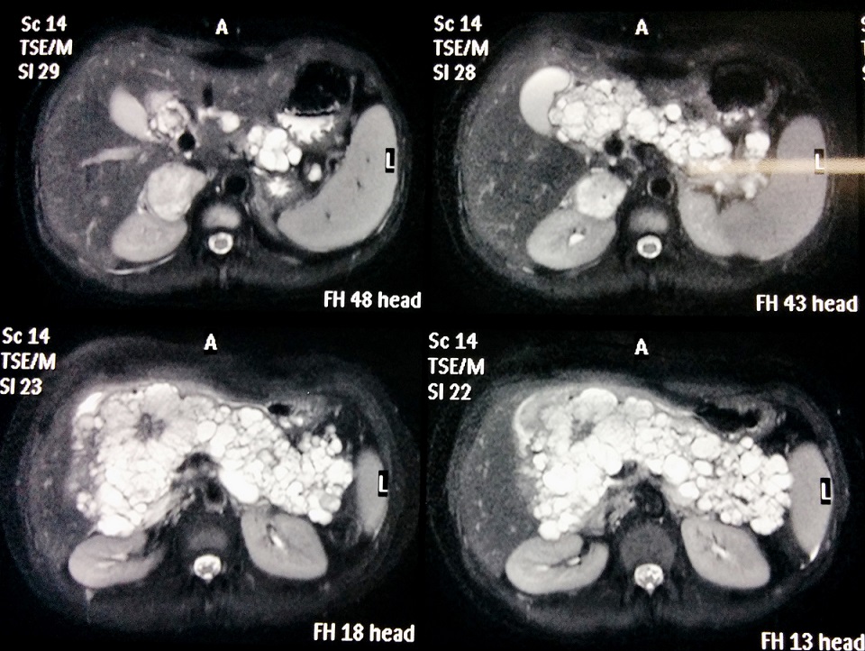 osteocare prospect Leziunile articulare ale bolii Crohn