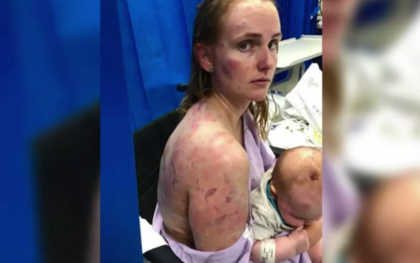 O mamă și-a folosit trupul ca scut pentru a-și proteja bebelușul de 4 luni