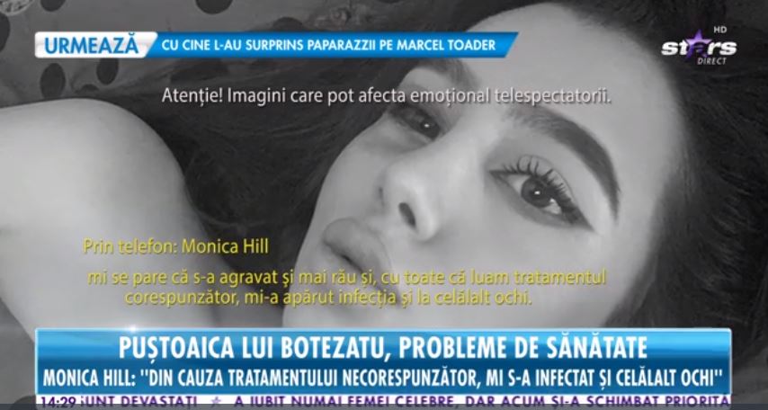 Monica Hill, iubita lui Cătălin Botezatu, suferă de o afecțiune gravă la ochi. În ce stadiu e acum