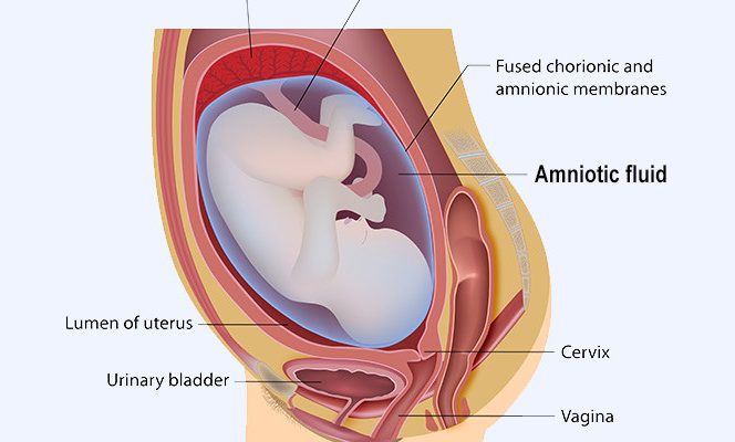 embolia cu lichid amniotic